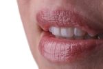 Licówki porcelanowe vs kompozytowe (bonding) - co wybrać, by cieszyć się trwałym efektem?